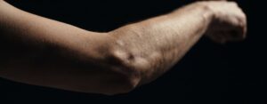 Coude fléchi vu de l'extérieur sur fond sombre, épicondyle éclairé par une lumière rasante