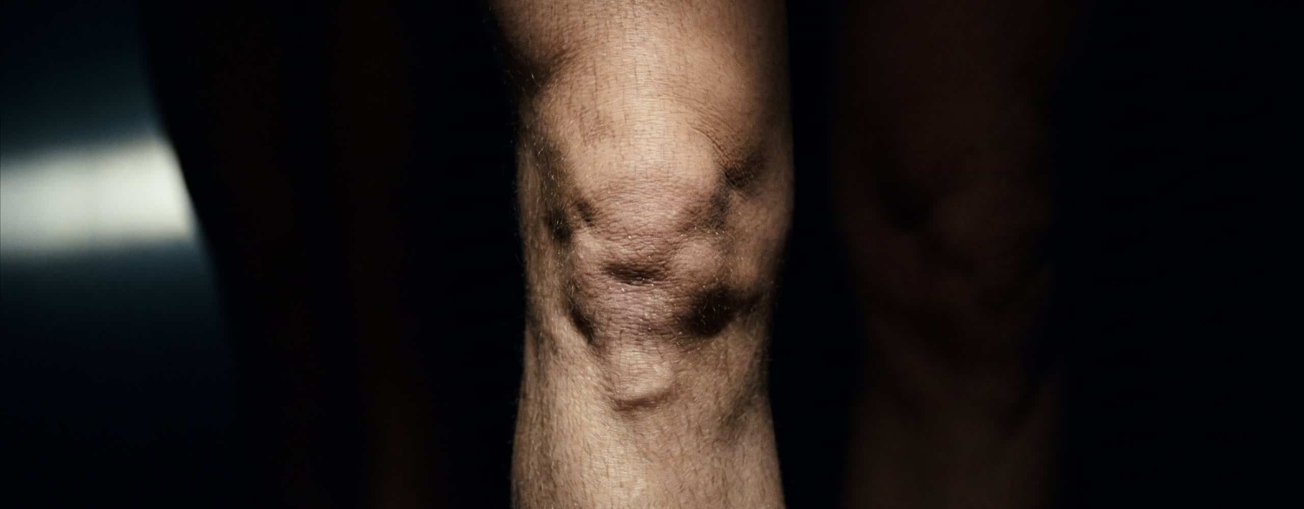 Genou vu de face sur fond sombre, rotule et relief du tendon rotulien éclairés par une lumière rasante